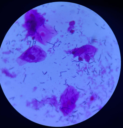 Microscopia - Microbiota Saudável